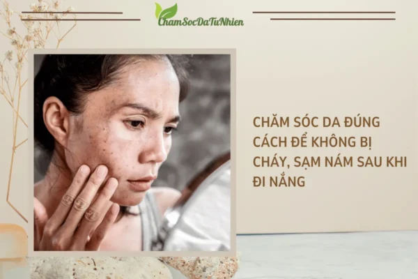 Chăm sóc da đúng cách để không bị cháy, sạm nám sau khi đi nắng