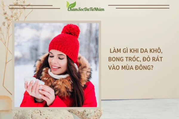 Làm gì khi da khô, bong tróc, đỏ rát vào mùa đông