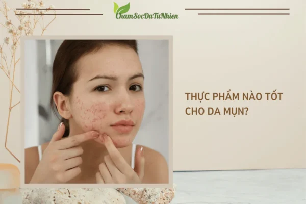 Thực phẩm nào tốt cho da mụn