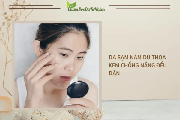 Da sạm nám dù thoa kem chống nắng đều đặn