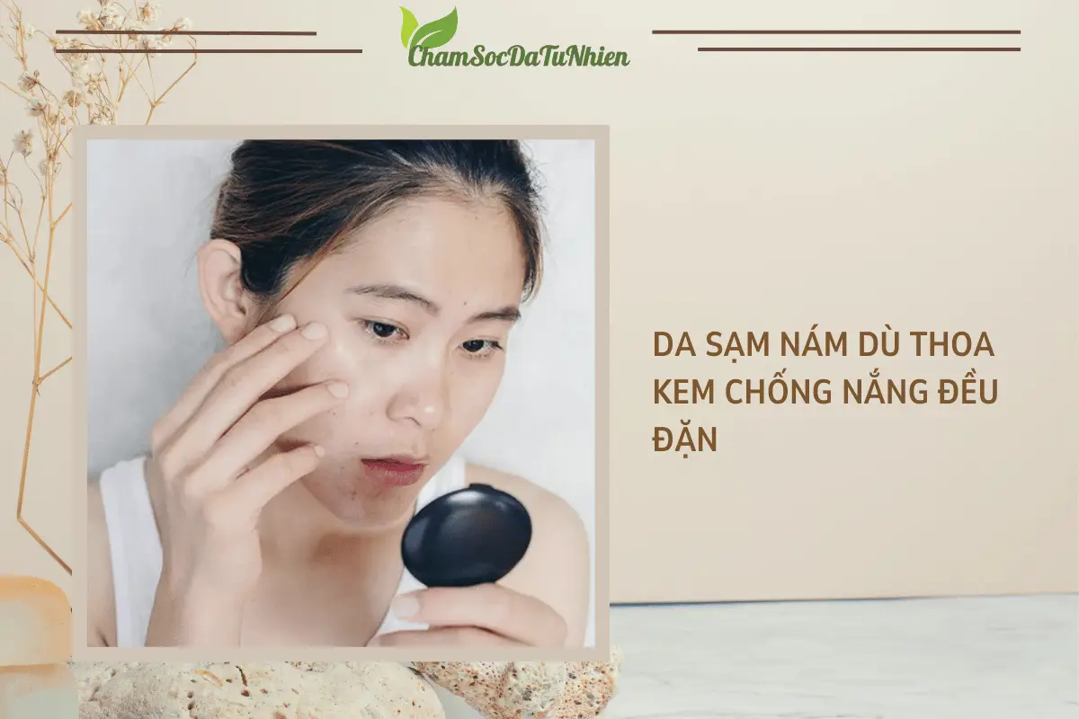 Da sạm nám dù thoa kem chống nắng đều đặn