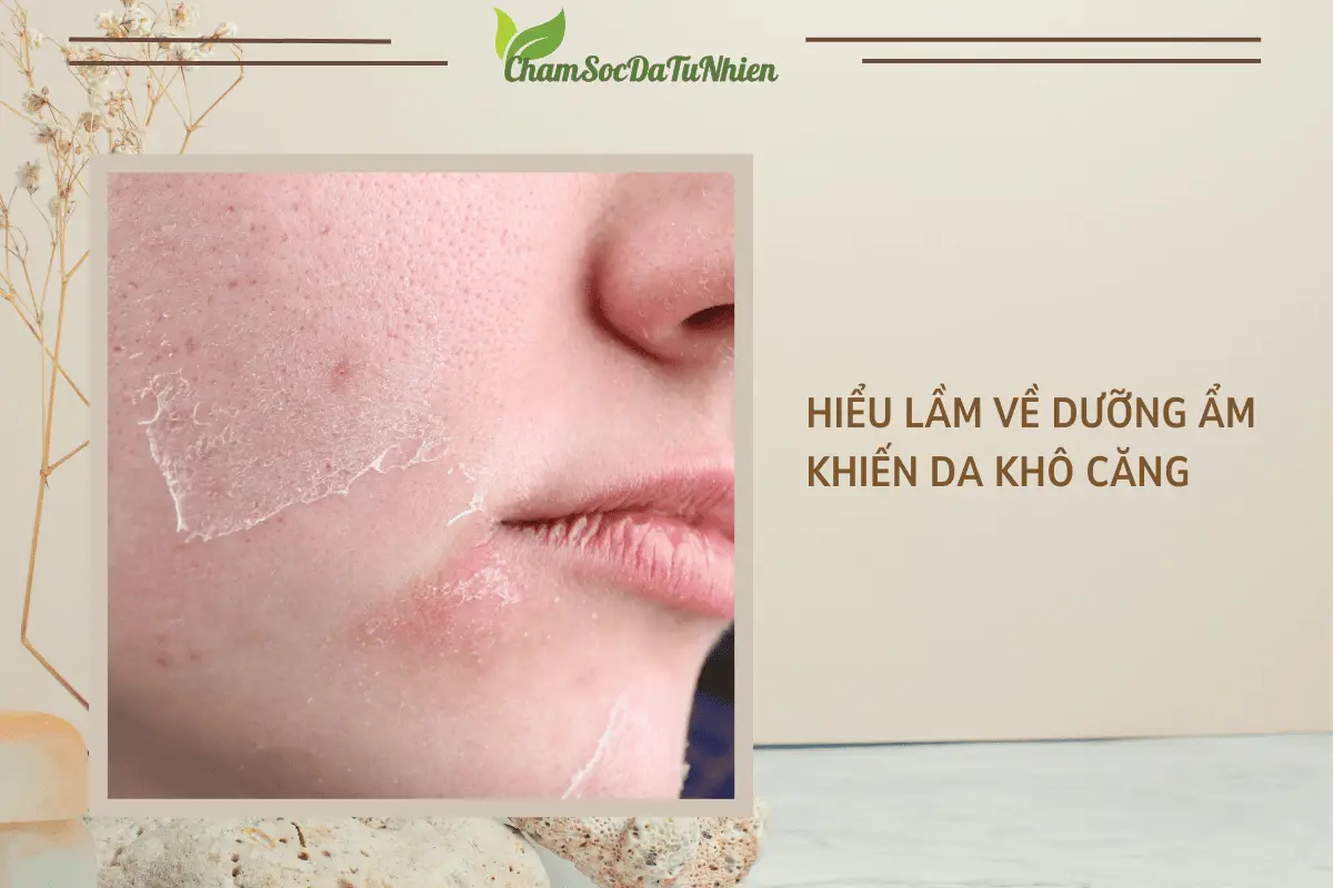 Hiểu lầm về dưỡng ẩm khiến da khô căng