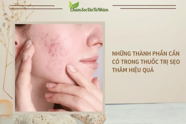 Những thành phần cần có trong thuốc trị sẹo thâm hiệu quả
