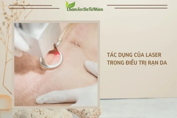 Tác dụng của laser trong điều trị rạn da