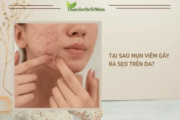 Tại sao mụn viêm gây ra sẹo trên da