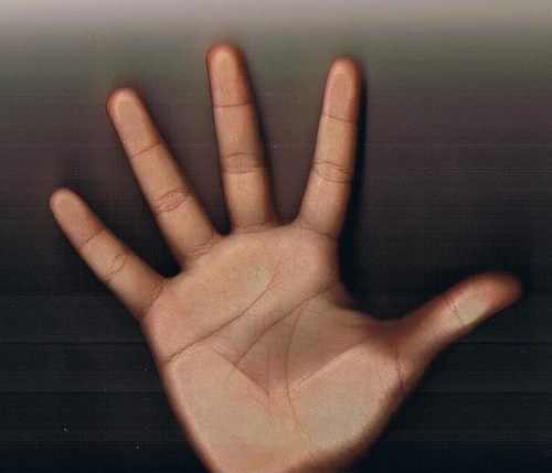 Phau thuat chi tay, thay doi van menh hinh anh