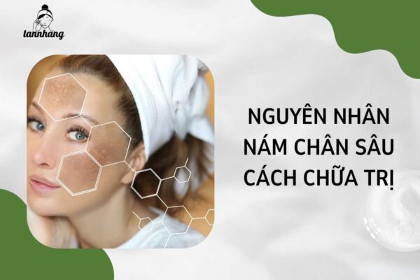 Nguyên nhân Nám chân sâu và cách chữa trị (3)