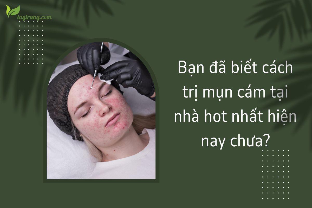 Bạn đã biết cách trị mụn cám tại nhà hot nhất hiện nay chưa (1)