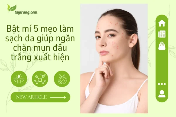 Bật mí 5 mẹo làm sạch da giúp ngăn chặn mụn đầu trắng xuất hiện