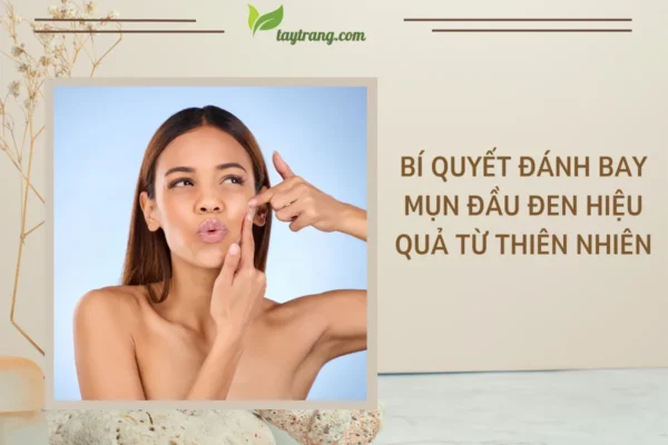 Bí quyết đánh bay mụn đầu đen hiệu quả từ thiên nhiên