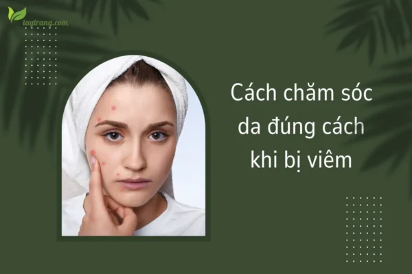 Cách chăm sóc da đúng cách khi bị viêm