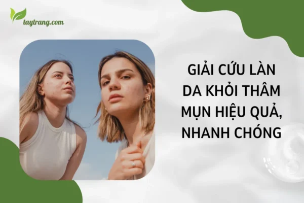 Giải cứu làn da khỏi thâm mụn hiệu quả, nhanh chóng