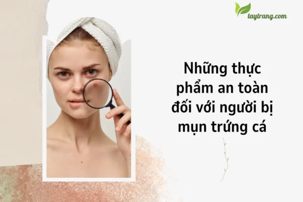 Những thực phẩm an toàn đối với người bị mụn trứng cá