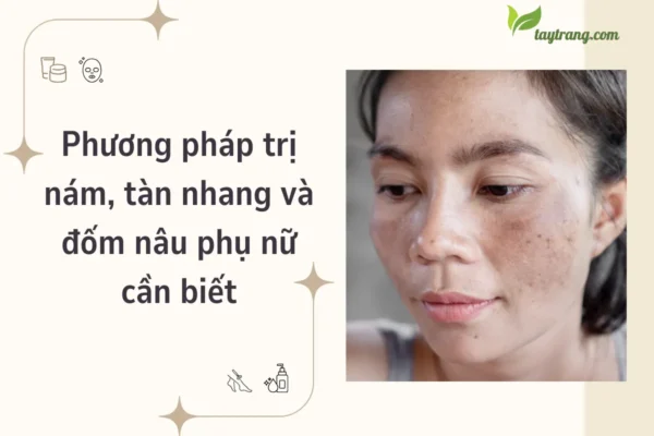 Phương pháp trị nám, tàn nhang và đốm nâu phụ nữ cần biết