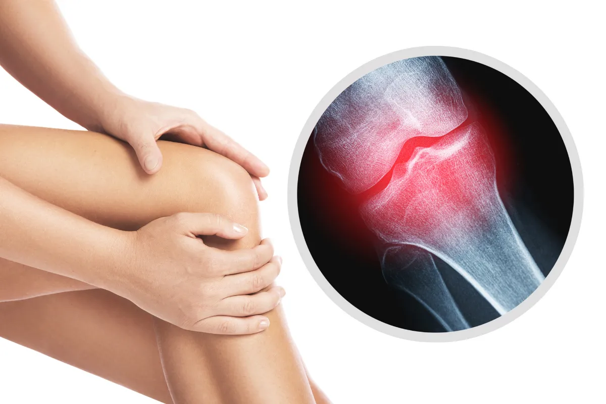 Các bệnh xương khớp