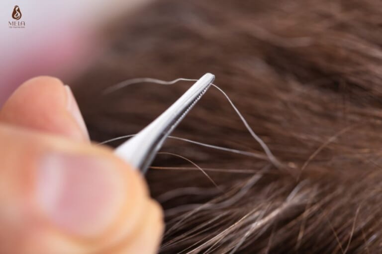 8 phương pháp biến tóc bạc thành tóc đen ngay tại nhà ai cũng cần biết